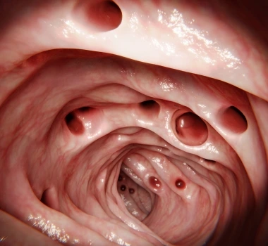 Coloproctología en Coyoacán